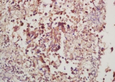 Phospho-P70 S6 Kinase beta (Thr228) Rabbit Polyclonal Antibody